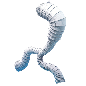 Aorfix™腹主动脉覆膜支架系统